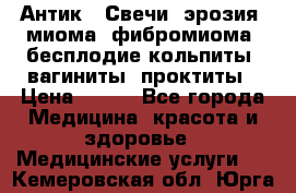 Антик.  Свечи (эрозия, миома, фибромиома, бесплодие,кольпиты, вагиниты, проктиты › Цена ­ 550 - Все города Медицина, красота и здоровье » Медицинские услуги   . Кемеровская обл.,Юрга г.